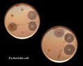 escherichia coli